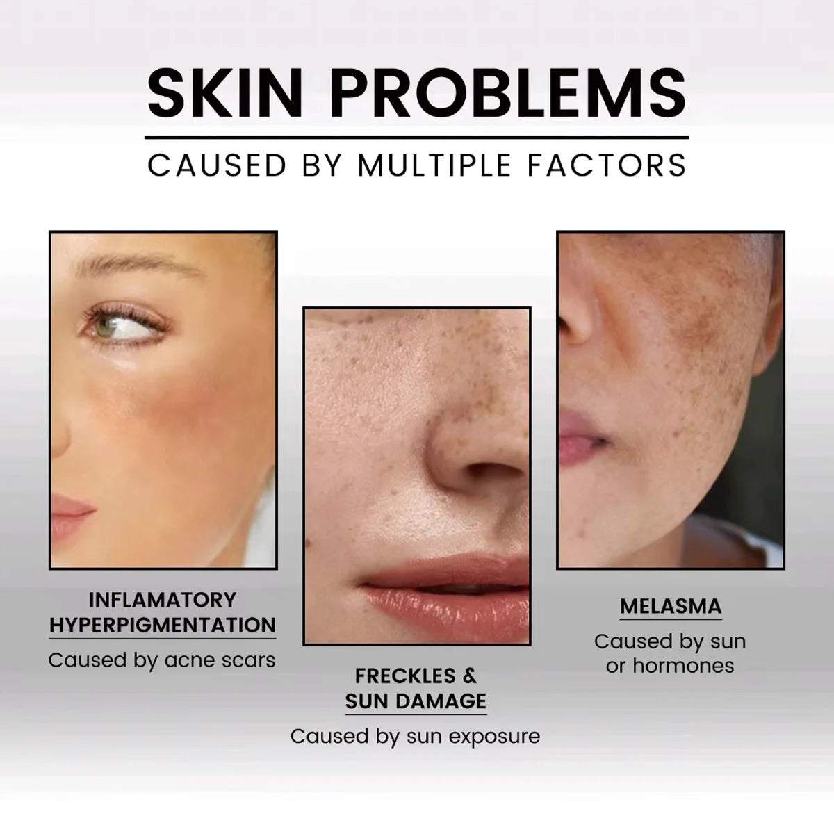 Pure Natural Vitamin E Oil Face Body Massage Spa Avocado Essential Oils Cold Pressed Moisturizer Serum